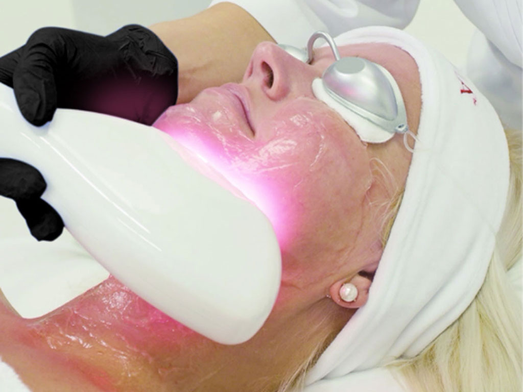Skin Tightening with Zaffiro